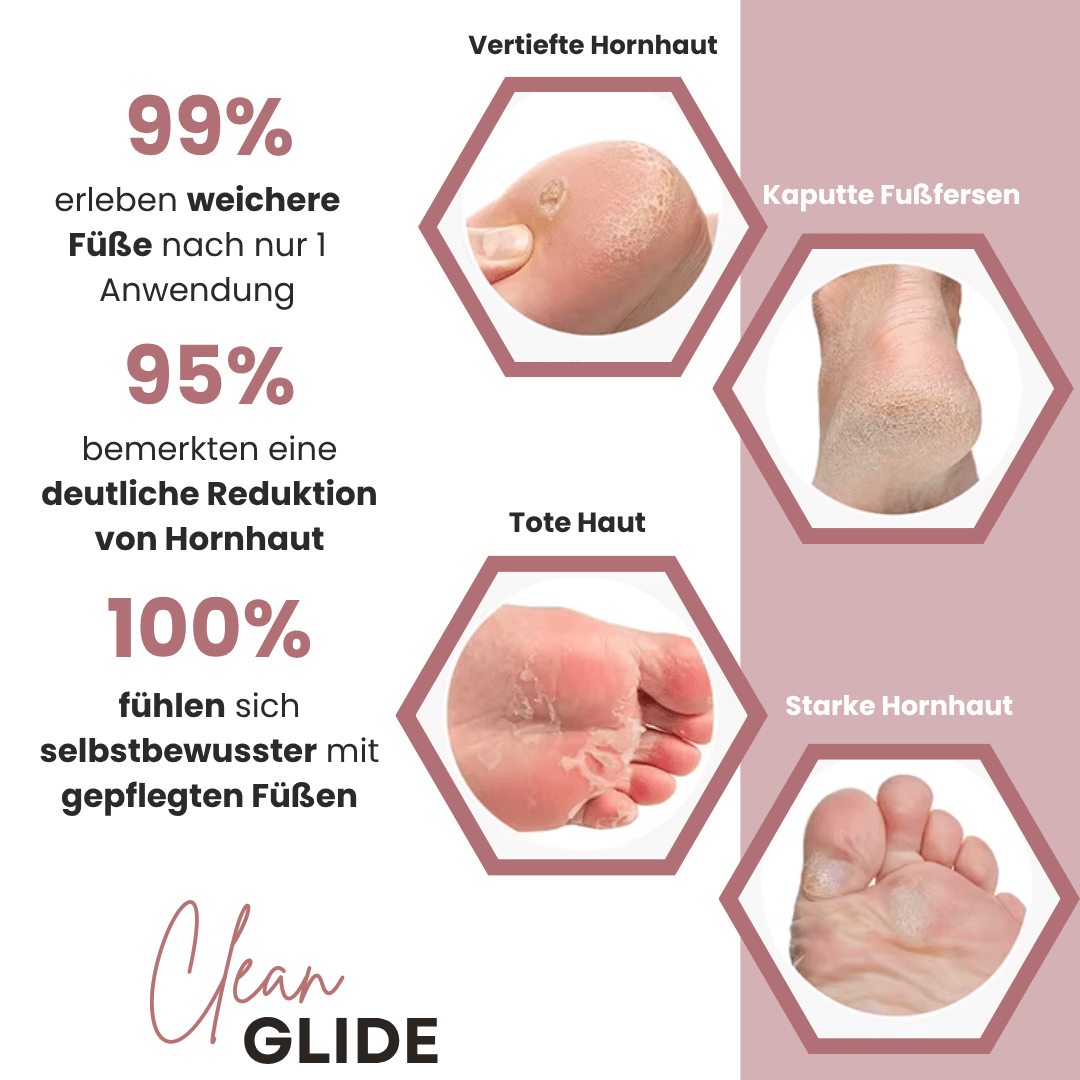 CleanGlide inkl. 60 GlidePads - Clean.