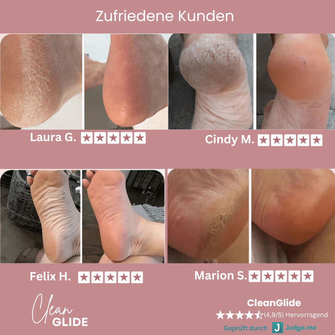 CleanGlide inkl. 60 GlidePads - Clean.