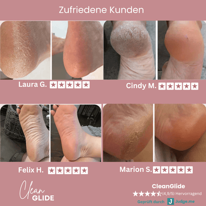 CleanGlide inkl. 60 GlidePads - Clean.