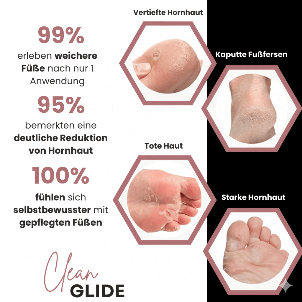 CleanGlide Schwarz inkl. 60 GlidePads - Clean.