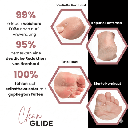 CleanGlide Schwarz inkl. 60 GlidePads - Clean.